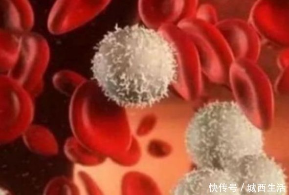 化学物质|超市里三种水果,含有大量甲醛,诱发白血病,不要再给小孩吃了