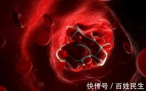 血管|天然的“清道夫”找到了,每天多吃点,血管通畅,血栓一去无踪