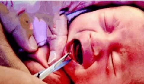 孩子|娃娃出生后只顾着笑,奶奶一巴掌将孩子打哭,医生却夸赞打得对