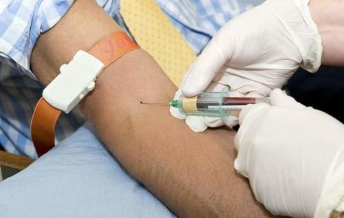 长期服用他汀类药物,需要做什么检查,多长时间查一次?