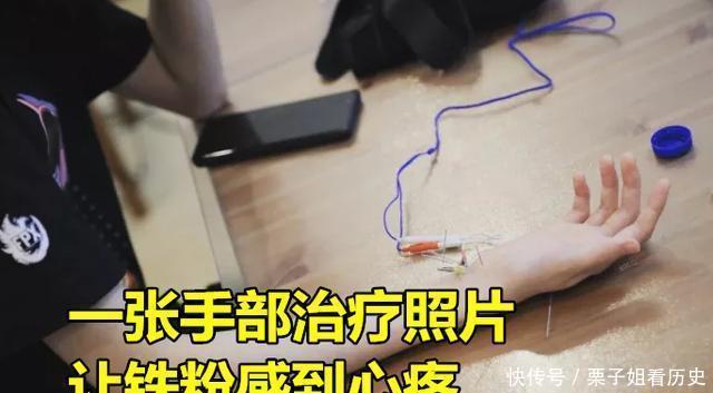 选手|TES阿水因病休息，FPX小天又传来坏消息，1张手部照片让铁粉心疼！