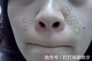 皂基类|皮肤专家提醒 3类洗面奶是毁脸系, 知情人士都不用, 你却蒙鼓里!