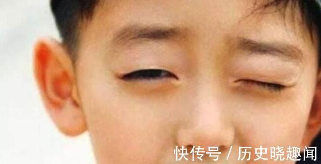 亮亮|孩子频繁眨眼睛,是小儿抽动症的信号?或许跟几个方面有关
