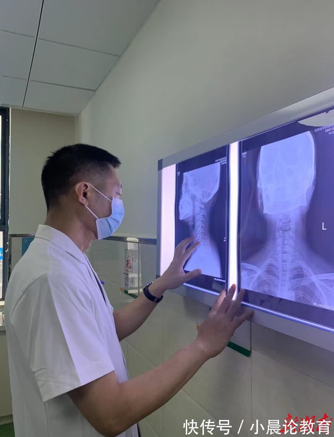 颈椎间盘|抗疫辛苦了！ 推拿医生教您治疗颈椎病