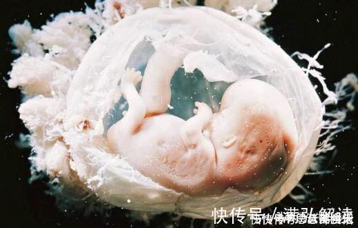 医生|现实版“哪吒”,产妇生下“带壳”宝宝想遗弃,医生:你太幸运了