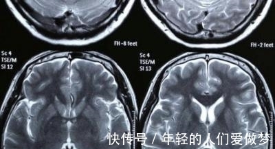 神奇的孩子|女儿智商异于常人,父母非常骄傲,检查后医生一句话父母冷汗直流