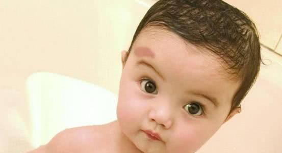 孕期|孕期,这2件容易让胎宝宝长胎记的事最好别做,不然后悔都来不及