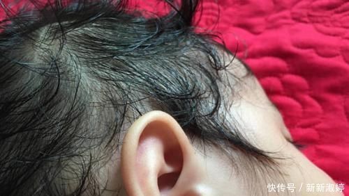 表姐|孩子这些睡姿家长还认为是可爱?错!那是脾胃的求救信号,别大意