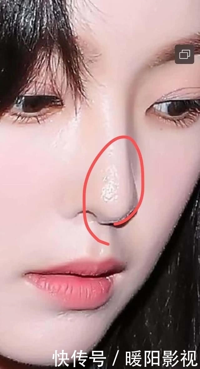 堵塞|美颜滤镜都救不了南韩颜霸裴珠泫的毛孔,如何告别毛孔粗大呢