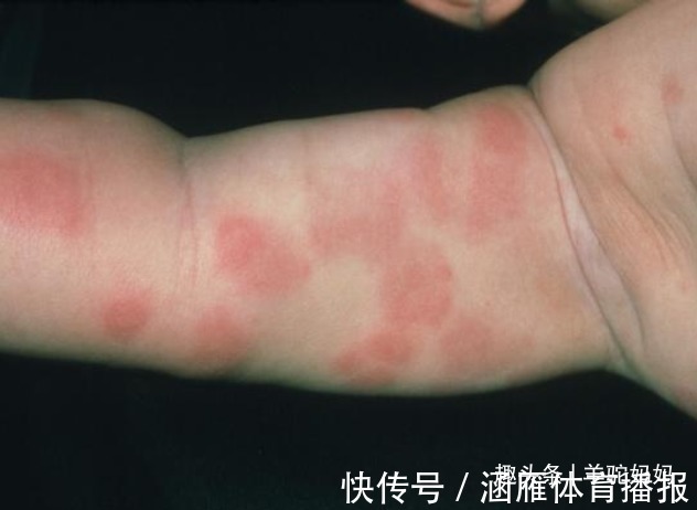 儿科医生|为什么不能给宝宝吃“鸡蛋羹”?儿科医生多次强调,家长要重视