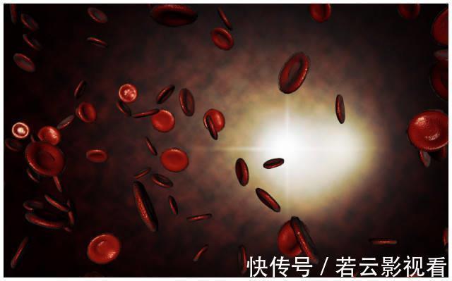 血脂异常|血脂高不高,看脸就知道,若没有这3个症状,恭喜血脂控制得不错