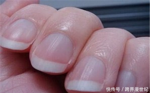 现了问题|养肝就是养命,肝不好会有4点表现,如果没有说明肝是健康的