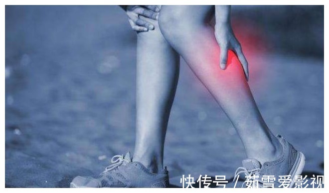 现象|双腿或是血脂的“晴雨表”？腿上出现这3种现象，血脂可能偏高了