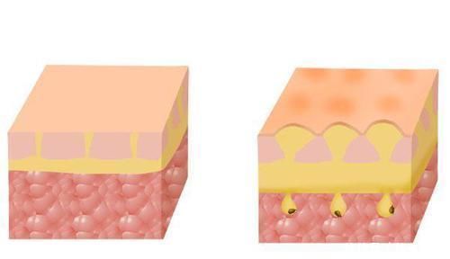 螨虫以什么为食不管是否想到,对健康的威胁,别视而不见