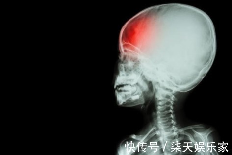 小知识|中风是很可怕的疾病,如果不幸患上中风那就是与时间赛跑!