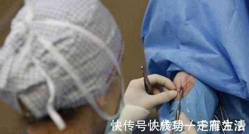 侧切|孕妇须知:顺产侧切后,缝针会不会很疼?答案跟你想的不一样