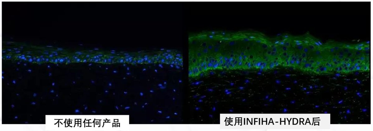 护肤 功能性护肤品爆发式增长 华熙生物跑赢靠什么？