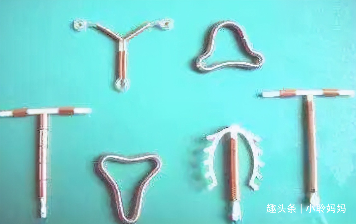 结扎|生二胎时要不要顺便结扎过来人的忠告很现实,不听早晚会后悔