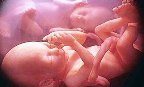 外婆家|说说双胞胎知识:双胞胎分开养会怎么样?影响比你想象中还大!