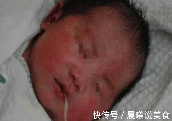 白粥|一岁宝宝肾衰竭意外死亡,原因是妈妈喂的白粥,各位家长要注意