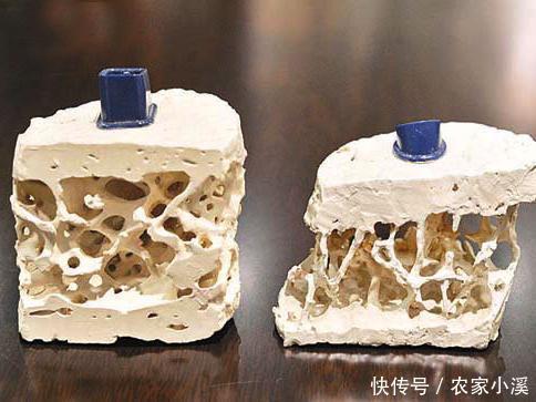 维生素e|原来吃虾皮并不补钙?医生:真正补钙的4种食物,很多人并不爱吃