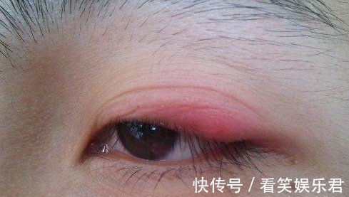 老中医|老中医告诫:6个症状是脾虚信号!艾灸5穴最养脾,脾不虚,病不找