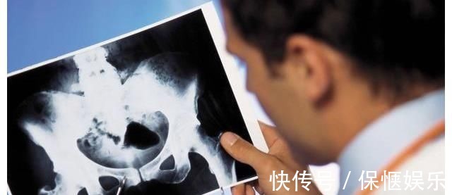 喝牛奶|吃一口等于8杯豆浆，骨科主任：骨不好的人坚持吃，还你“钢铁骨”