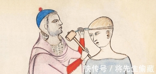 开颅手术&《山海经》中的“巫族”普遍存在于上古时期,史前文明真的存在?