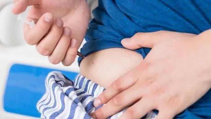 2型糖尿病|2型糖尿病 竟然能逆转?这两点是关键