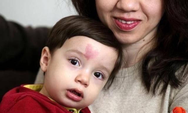 屁股|宝宝身上有淤青是来给父母报恩的如果胎记长成这样,家长要重视