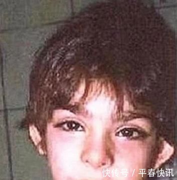 艺伎|宝宝长得太漂亮也是一种病?“歌舞伎综合征”到底是个什么鬼