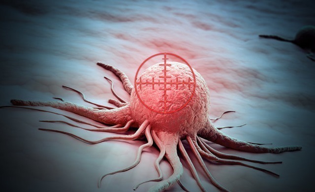 患者|为什么很多人得癌症之后,不治疗没事,一治反而很快人就去世了