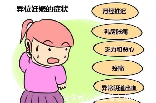 妇产科医生|女人怀上“宫外孕”,多半是男人的锅妇产科医生几句话挑出问题
