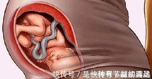 水肿|怀胎十月的最后一个月,肚子里宝宝在干吗其实他在“打包行李”