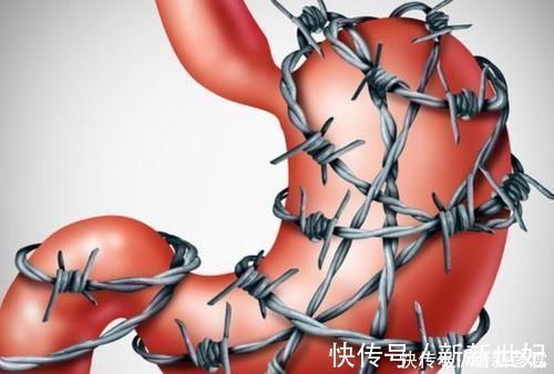 鸡内金|它是胃病“死敌”,这3种食材:灭菌养胃,将胃炎、溃疡拒之门外