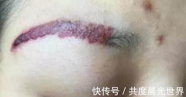 女生|为什么不建议女生纹眉内行人说出“实情”，看完再做决定也不晚