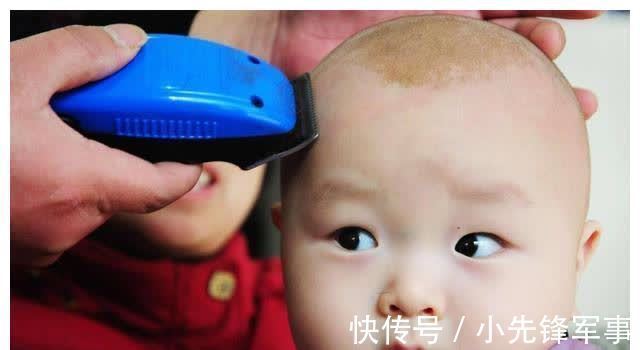 斑秃|娃的头发是发育的“标准”,发多发少家长要有数,关乎宝宝的健康