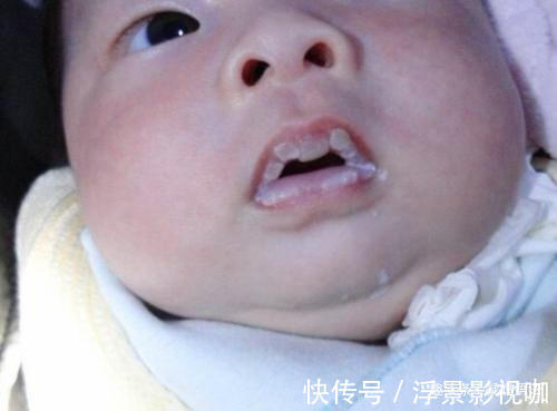 宝宝|3天新生儿喝母乳后就去了医院,医生检查后发现,还是妈妈惹的祸