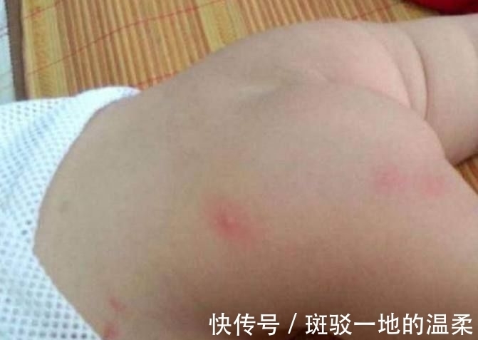 身子|睡觉时感觉身子痒痒的,是什么原因呢,该怎么办?