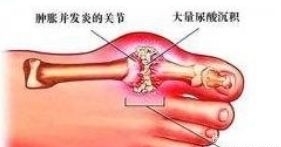 中医教授公开的10个中医秘方，非常实用！