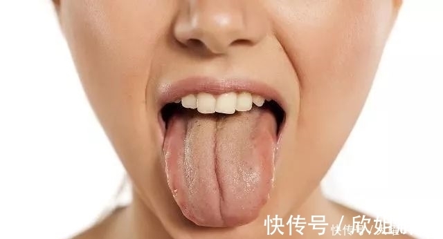 湿气|湿气不除，越补越虚！进补前这样做，祛湿调脾虚，轻松搞定！