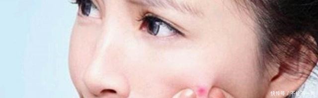 痘痘|刚把脸打湿就用洗面奶难怪痘痘黑头总是找上你!