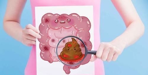 癌肿|排便不畅,是肠癌吗?医生:符合3个标准,尽早去医院检查一下