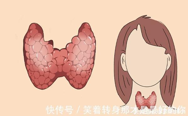 番茄|为何得甲状腺结节的，大部分都是女性？有助散结的食物有哪些？