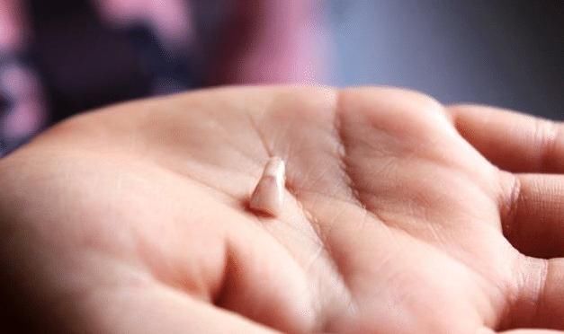 95后宝妈不信乳牙能救命，结果后悔不已，新手爸妈要注意