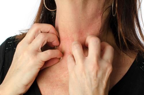 皮肤瘙痒|43岁大姐皮肤过敏，确诊甲状腺癌，医生：身体1处发痒，趁早检查