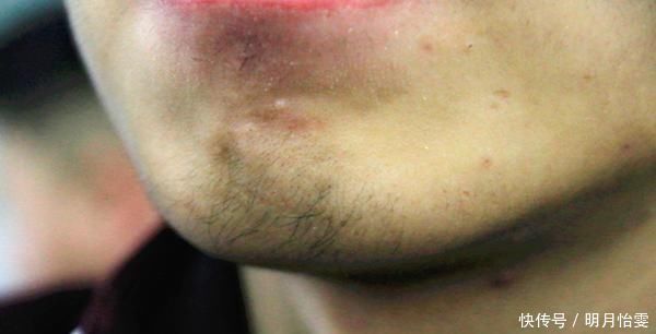 激素|一个男性，如果体内雄激素旺盛，身体会有3个特征，希望你都有