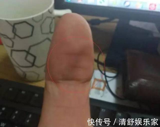 中风|三伏天,有一种“出汗”现象,是脑中风前兆,及时检查,莫忽视