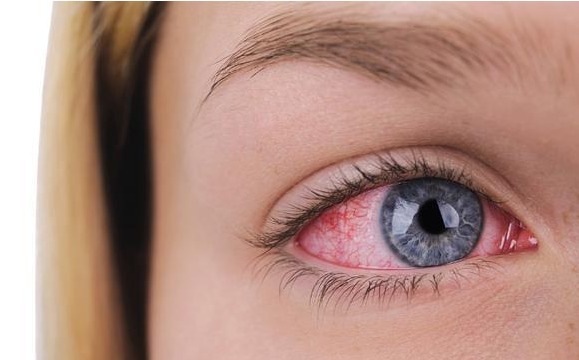 肝火过旺|肝火旺，会出现6个异常，勤饮一水，食二蔬，动三处，降火又护肝