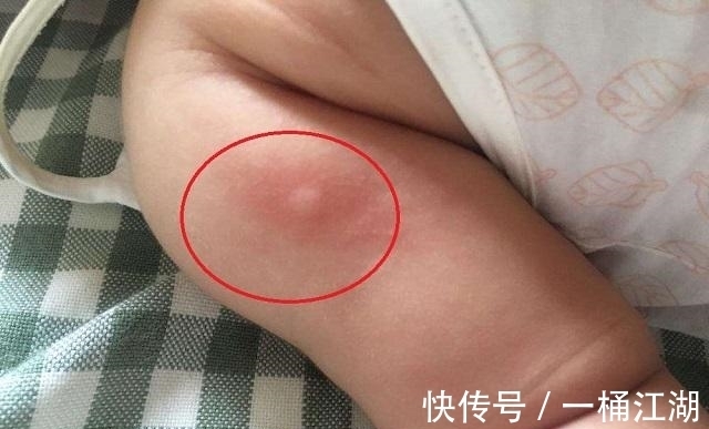 致命诱惑|蚊子的危害可致命!家有“招蚊宝宝”,试试这些驱蚊方法,很有效